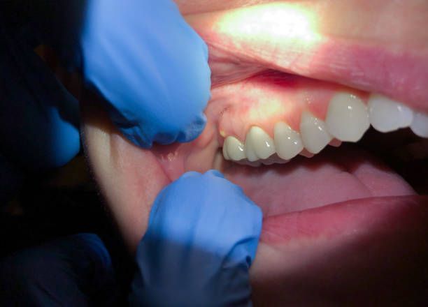 Urgent Tooth Repair in CT