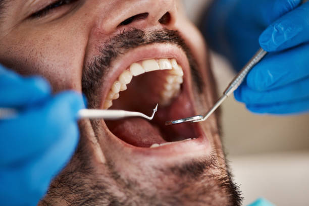 Best Chipped Tooth Repair Near Me  in Southwood Acres, CT