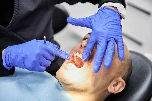 Best Broken Tooth Emergency  in Southwood Acres, CT